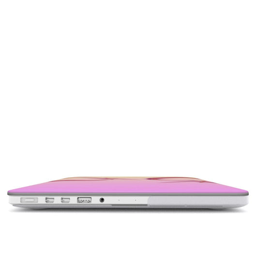 Halo MacBook Case