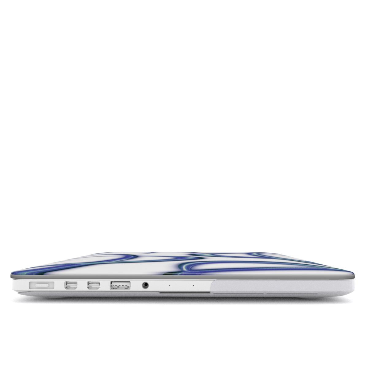 Vitium MacBook Case