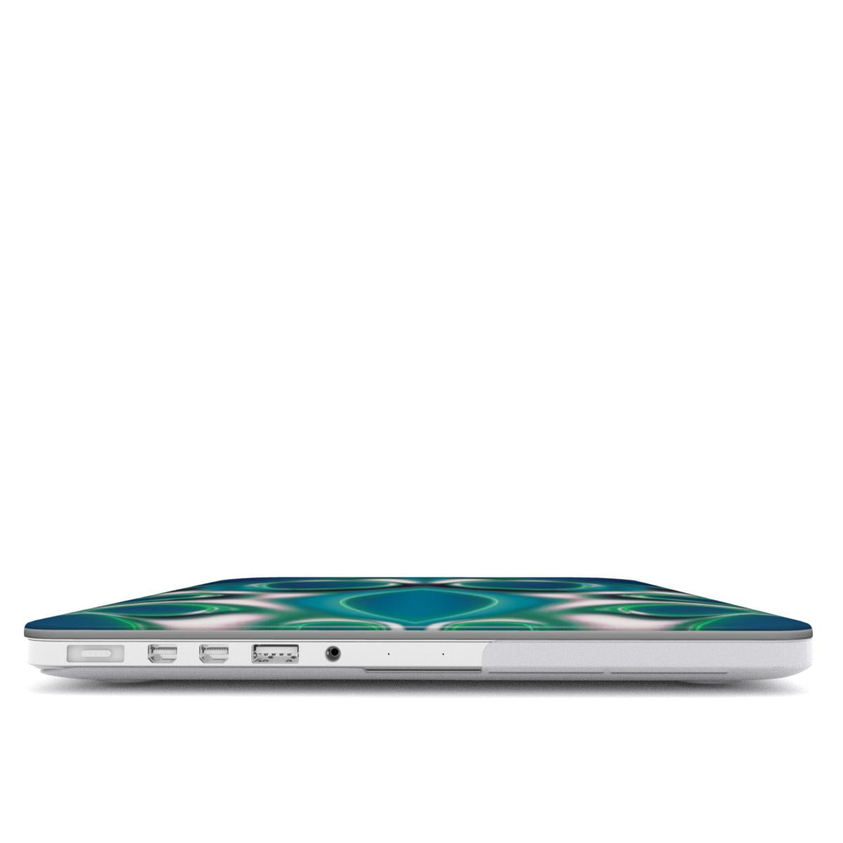 Viscera MacBook Case